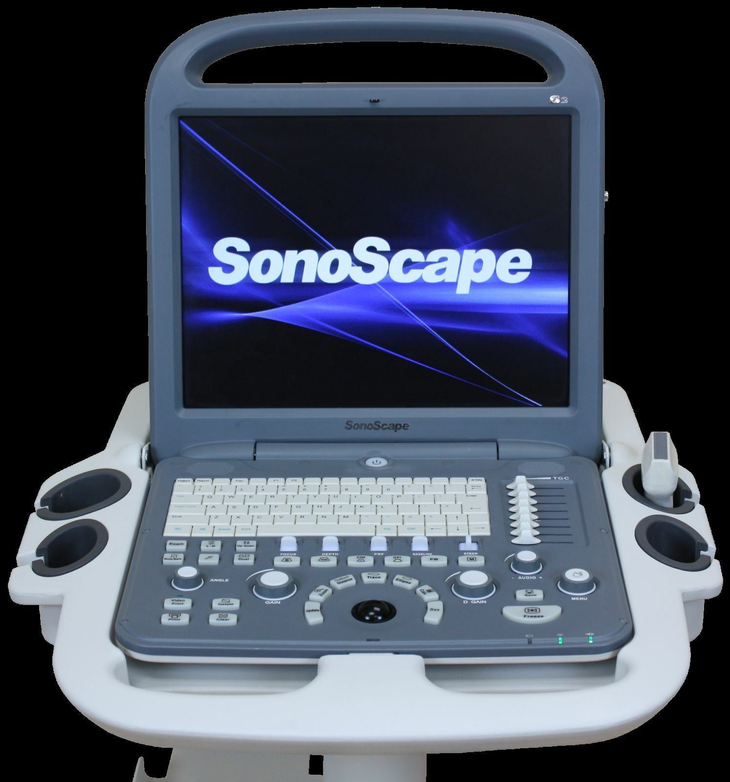 SonoScape S2 with one Linear array Probe L741 5.0-10.0 Mhz DIAGNOSTIC ULTRASOUND MACHINES FOR SALE