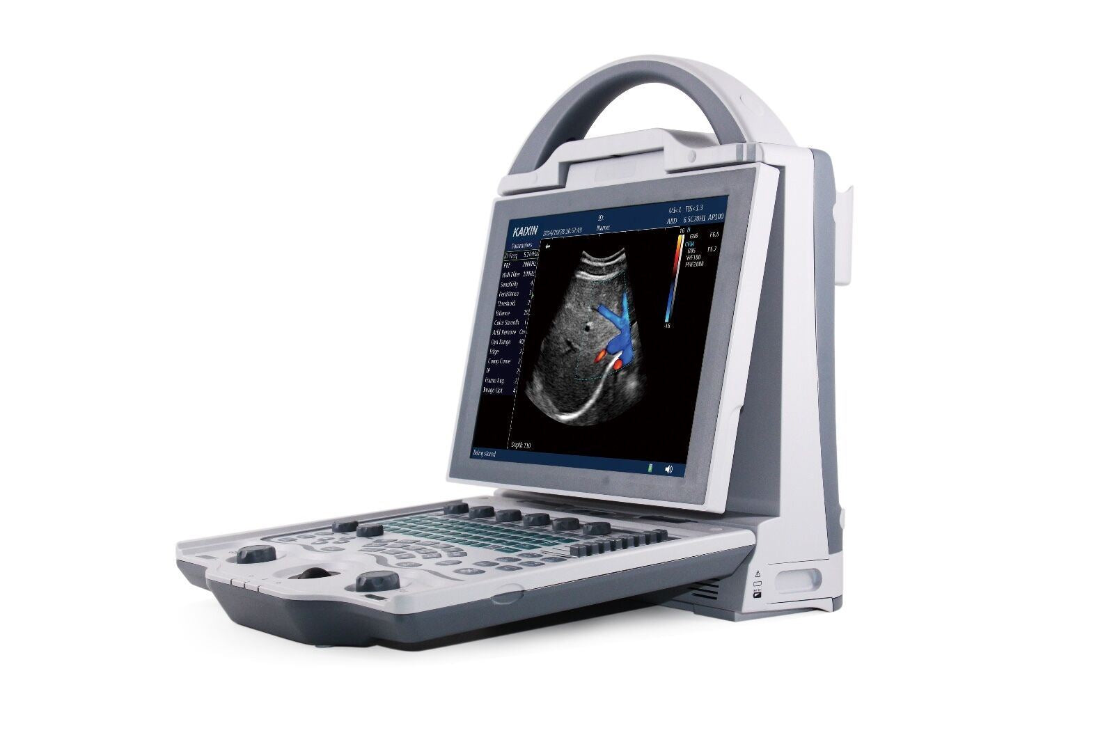 Color Doppler Ultrasound Scanner with one Probe DIAGNOSTIC ULTRASOUND MACHINES FOR SALE