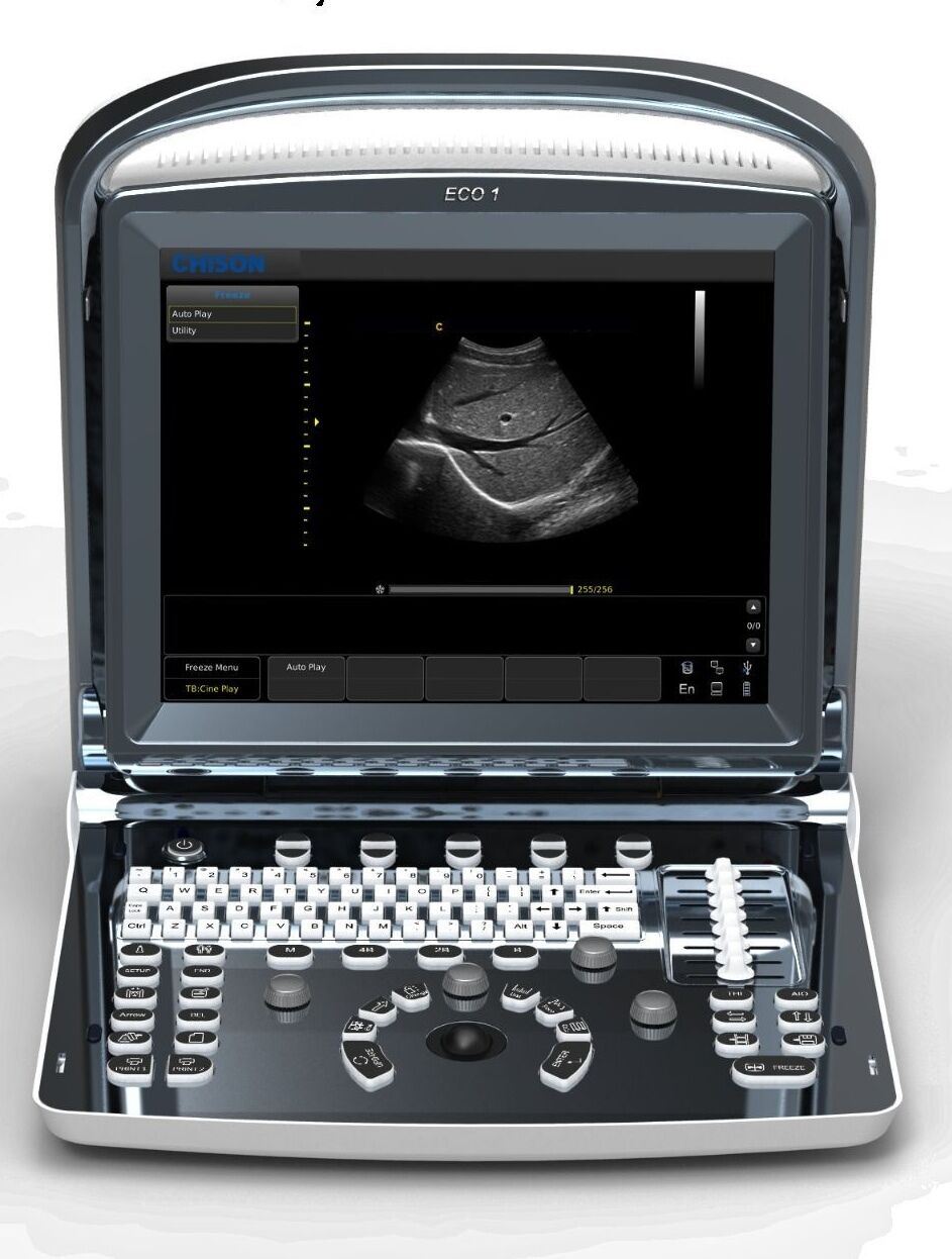 Chison ECO1 Portable LED Ultrasound Scanner two probes Convex & linear array DIAGNOSTIC ULTRASOUND MACHINES FOR SALE