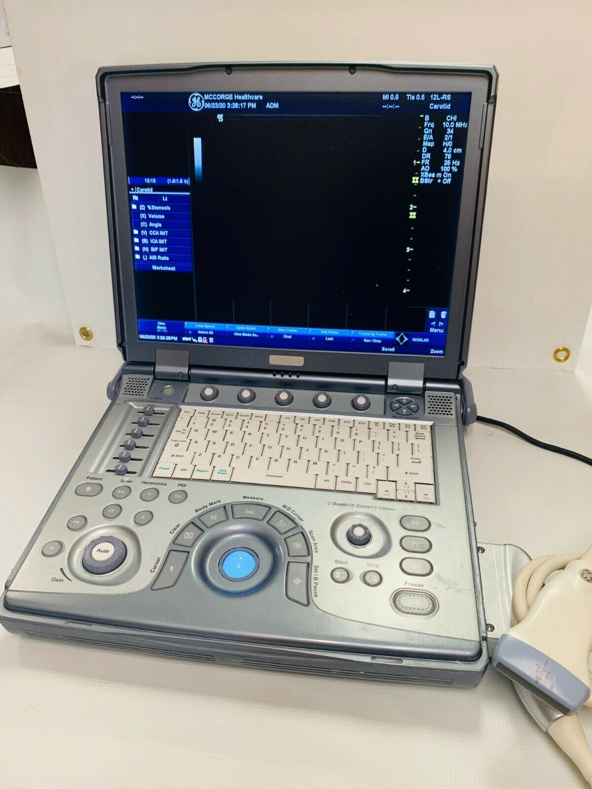 GE Logiq E Color Ultrasound Scanner, 3 probes Cardiac,Linear, convex 2011 DIAGNOSTIC ULTRASOUND MACHINES FOR SALE