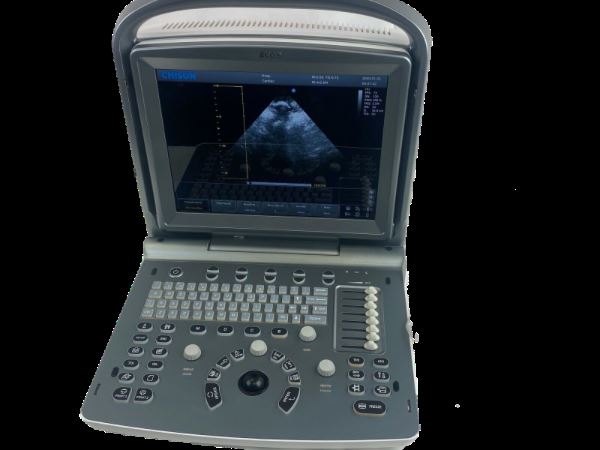 Chison ECO6 Portable Color doppler Ultrasound with CW and phase array probe P3E DIAGNOSTIC ULTRASOUND MACHINES FOR SALE