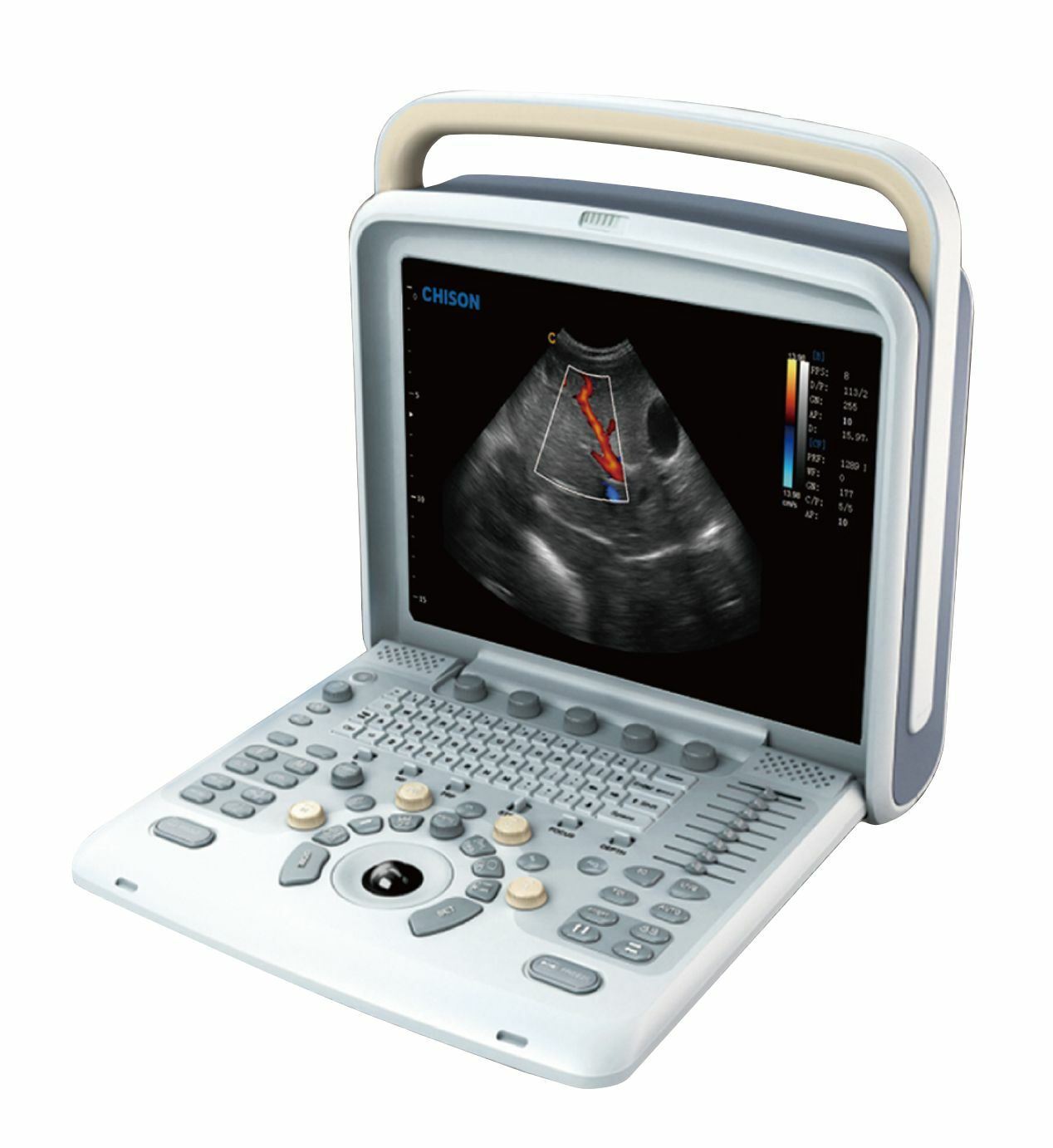 Veterinary Ultrasound Scanner with one Probes - Color Doppler Chison Q5Vet DIAGNOSTIC ULTRASOUND MACHINES FOR SALE