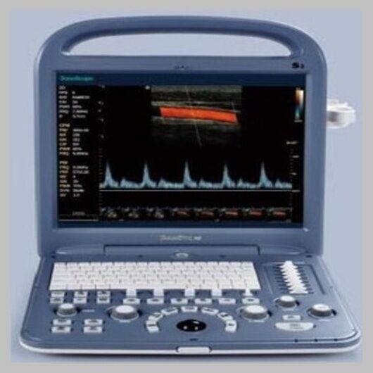 SonoScape S2 with Convex Abdominal Probe Included - Excellent Condition DIAGNOSTIC ULTRASOUND MACHINES FOR SALE