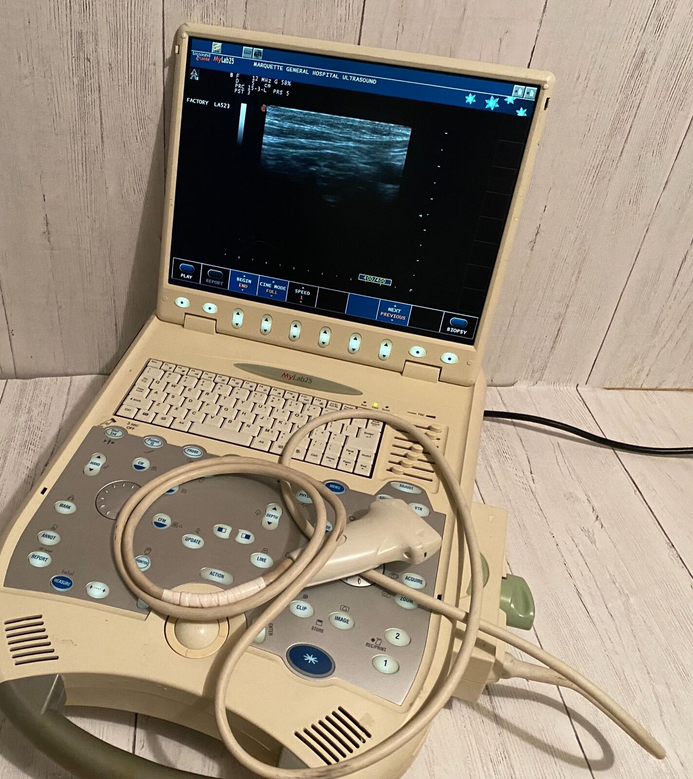 Esaote BioSound MyLab25 Portable Ultrasound with linear array probe 2005 DIAGNOSTIC ULTRASOUND MACHINES FOR SALE