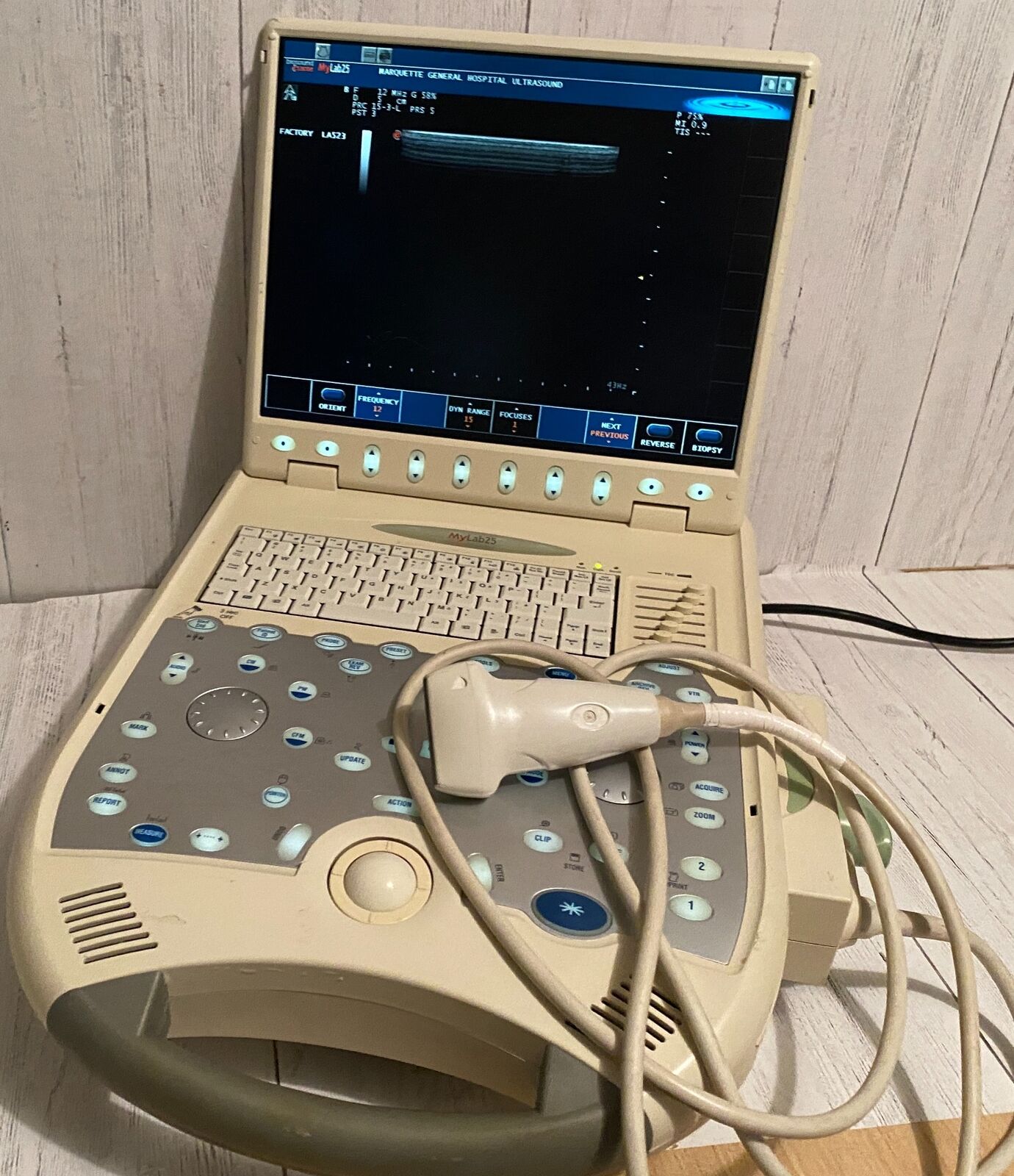 Esaote BioSound MyLab25 Portable Ultrasound with linear array probe 2005 DIAGNOSTIC ULTRASOUND MACHINES FOR SALE