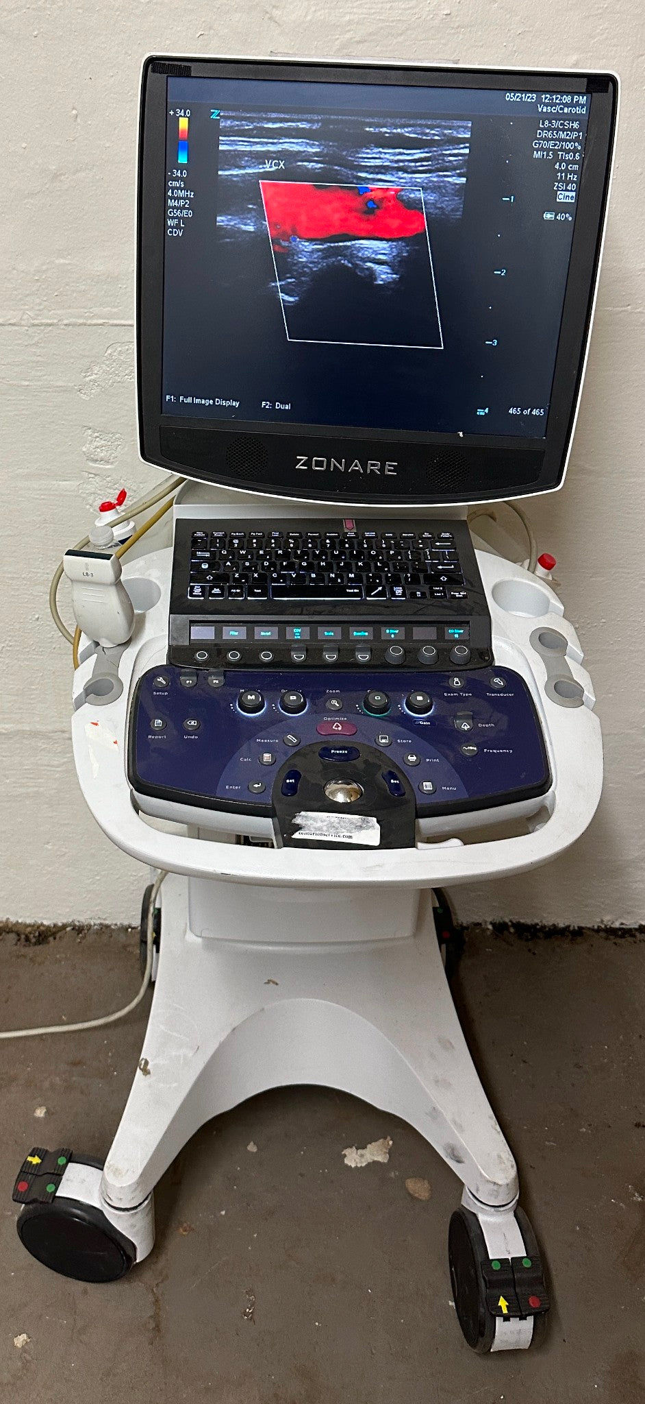 ZONARE ZS 3 Ultrasound Scanner Machine 2014 DIAGNOSTIC ULTRASOUND MACHINES FOR SALE