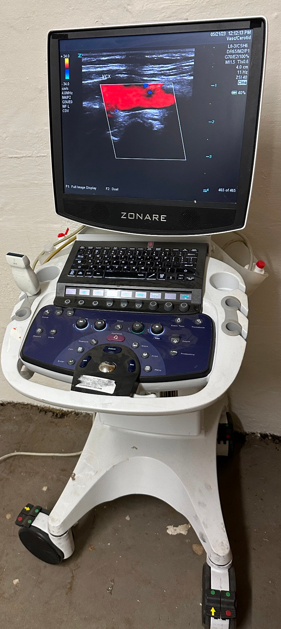 ZONARE ZS 3 Ultrasound Scanner Machine 2014 DIAGNOSTIC ULTRASOUND MACHINES FOR SALE