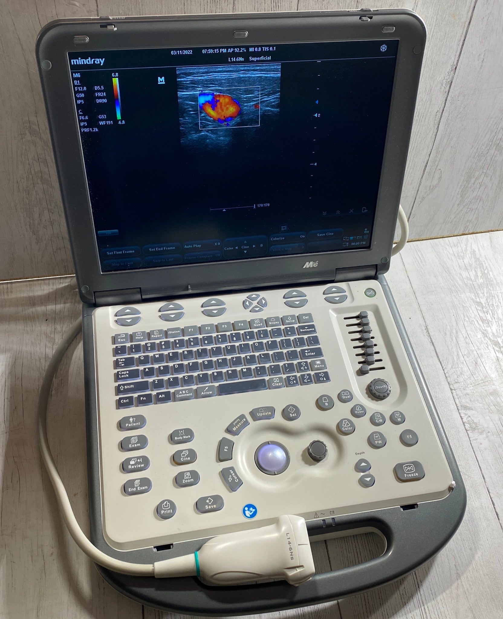 Mindray M6 Portable Ultraspund with one linear array probe L14-6NS 2018 DIAGNOSTIC ULTRASOUND MACHINES FOR SALE