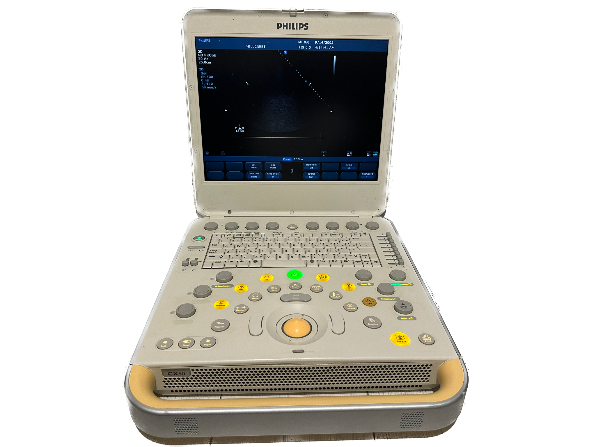 Philips CX50 2009 Ultrasound DIAGNOSTIC ULTRASOUND MACHINES FOR SALE