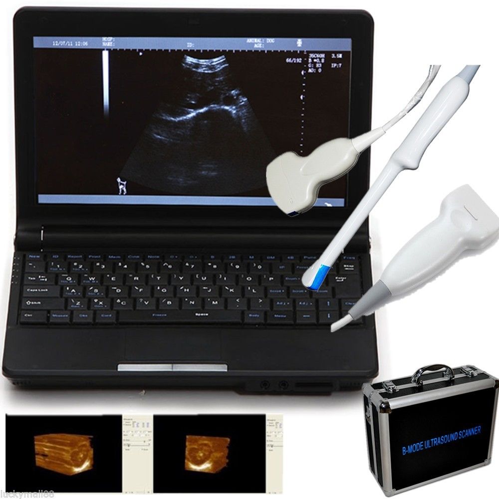 Set Portable Laptop Machine ultrasound scanner Probe Convex/Linear/Transvaginal 190891942104 DIAGNOSTIC ULTRASOUND MACHINES FOR SALE