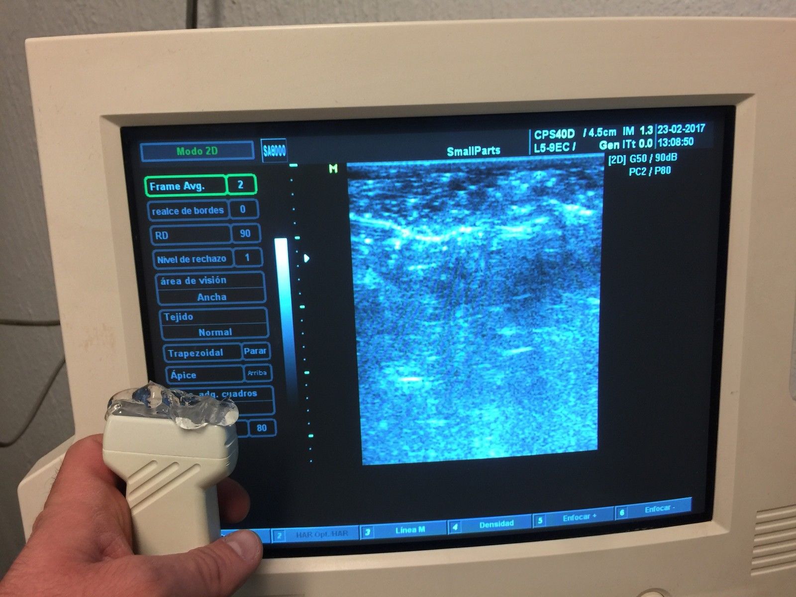 MEDISON L5-9 7.5 MHz Linear Probe FOR SA5500/6000/8800/8000SE/8000EX/8000LV/PICO DIAGNOSTIC ULTRASOUND MACHINES FOR SALE