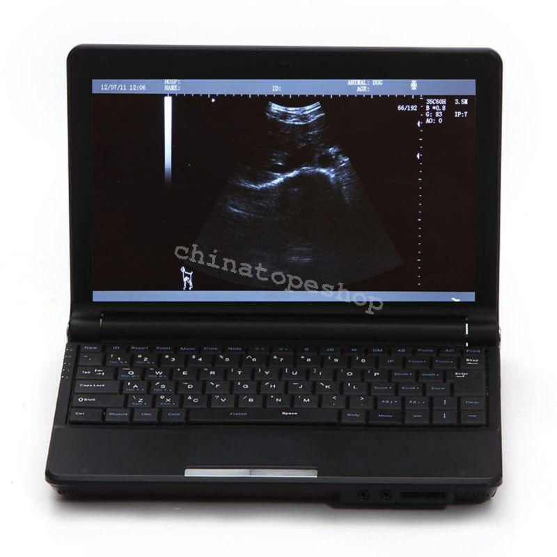 Digital Laptop Notebook ultrasound scanner machine Convex Linear 2 probes 3D 190891559289 DIAGNOSTIC ULTRASOUND MACHINES FOR SALE