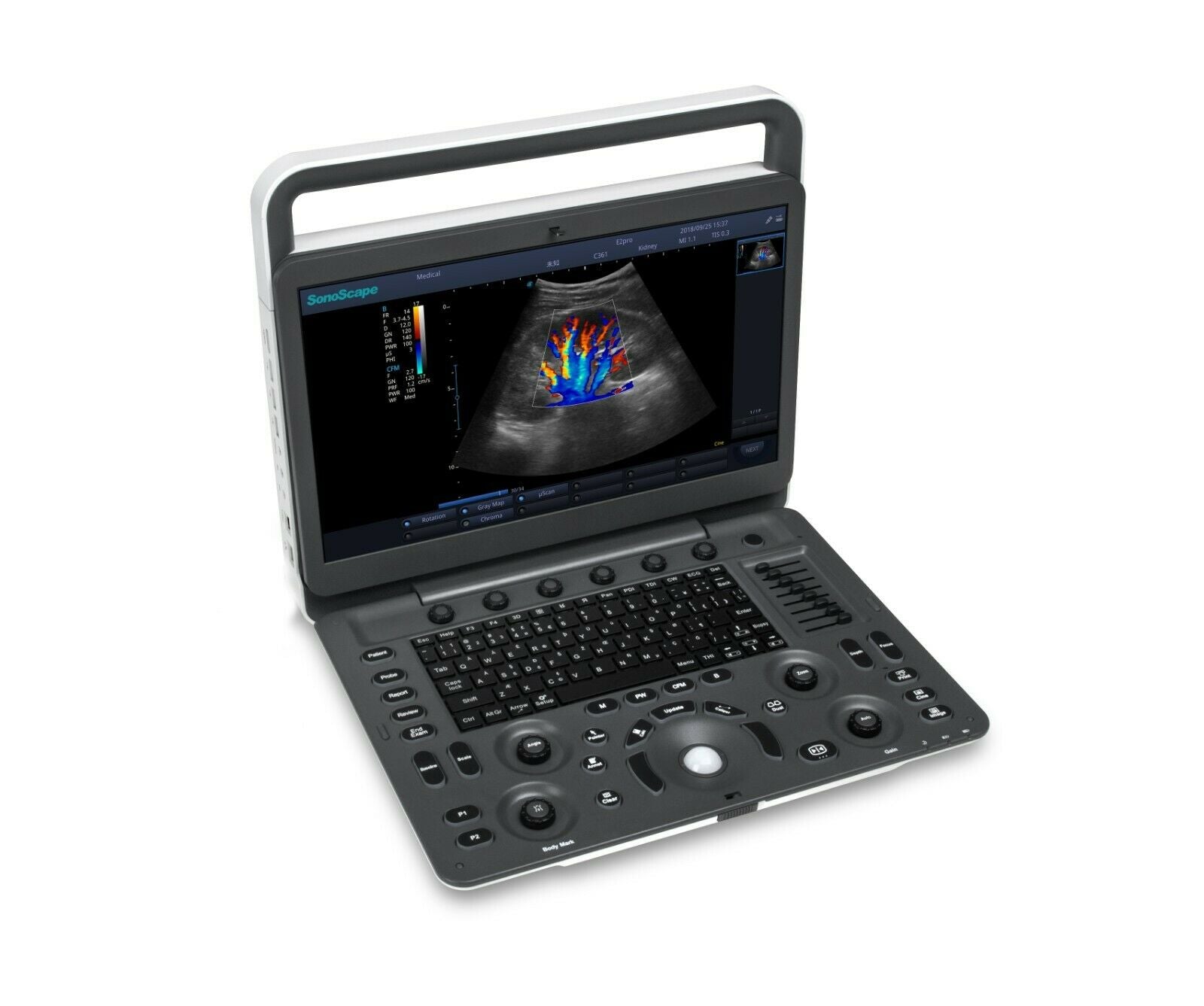 SonoScape E2 ultrasound & One linear array probe L741 Color doppler Vascular DIAGNOSTIC ULTRASOUND MACHINES FOR SALE