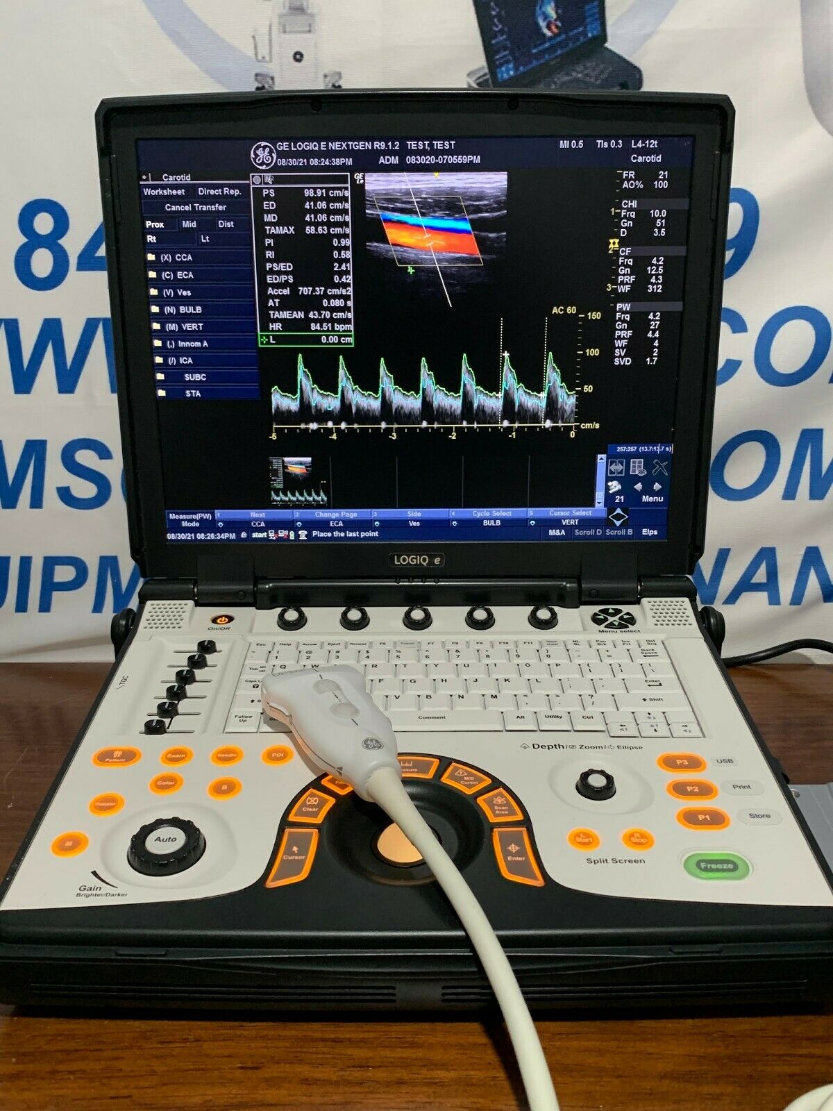 GE LOGIQ E NEXTGEN ULTRASOUND R.9.1.2 WITH 1 PROBE INCLUDED ALL OPTIONS ENABLED DIAGNOSTIC ULTRASOUND MACHINES FOR SALE