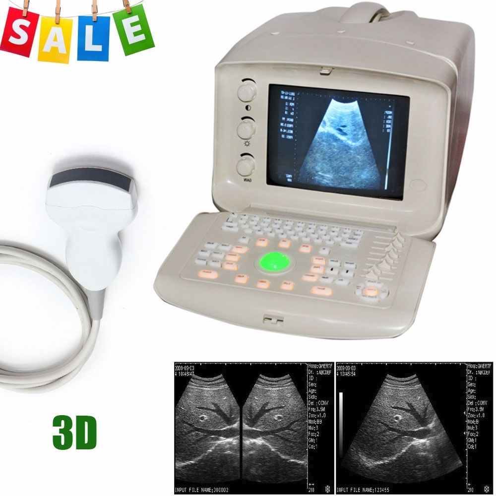 Digital Ultrasound Scanner/Machine 3.5Mhz Convex Transducer/Probe 3D A+ DIAGNOSTIC ULTRASOUND MACHINES FOR SALE