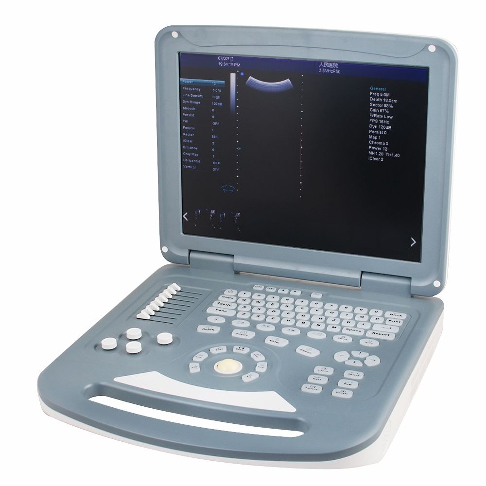 15" Doppler Ultrasound Diagnostic System Scanner Convex Transvaginal 2 Probe A+ 190891646774 DIAGNOSTIC ULTRASOUND MACHINES FOR SALE