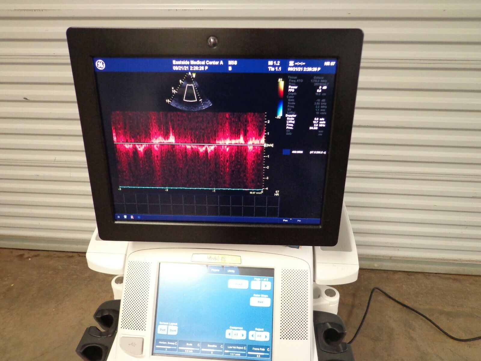 GE VIVID E9 Ultrasound System M5S Probe Color Roll DIAGNOSTIC ULTRASOUND MACHINES FOR SALE