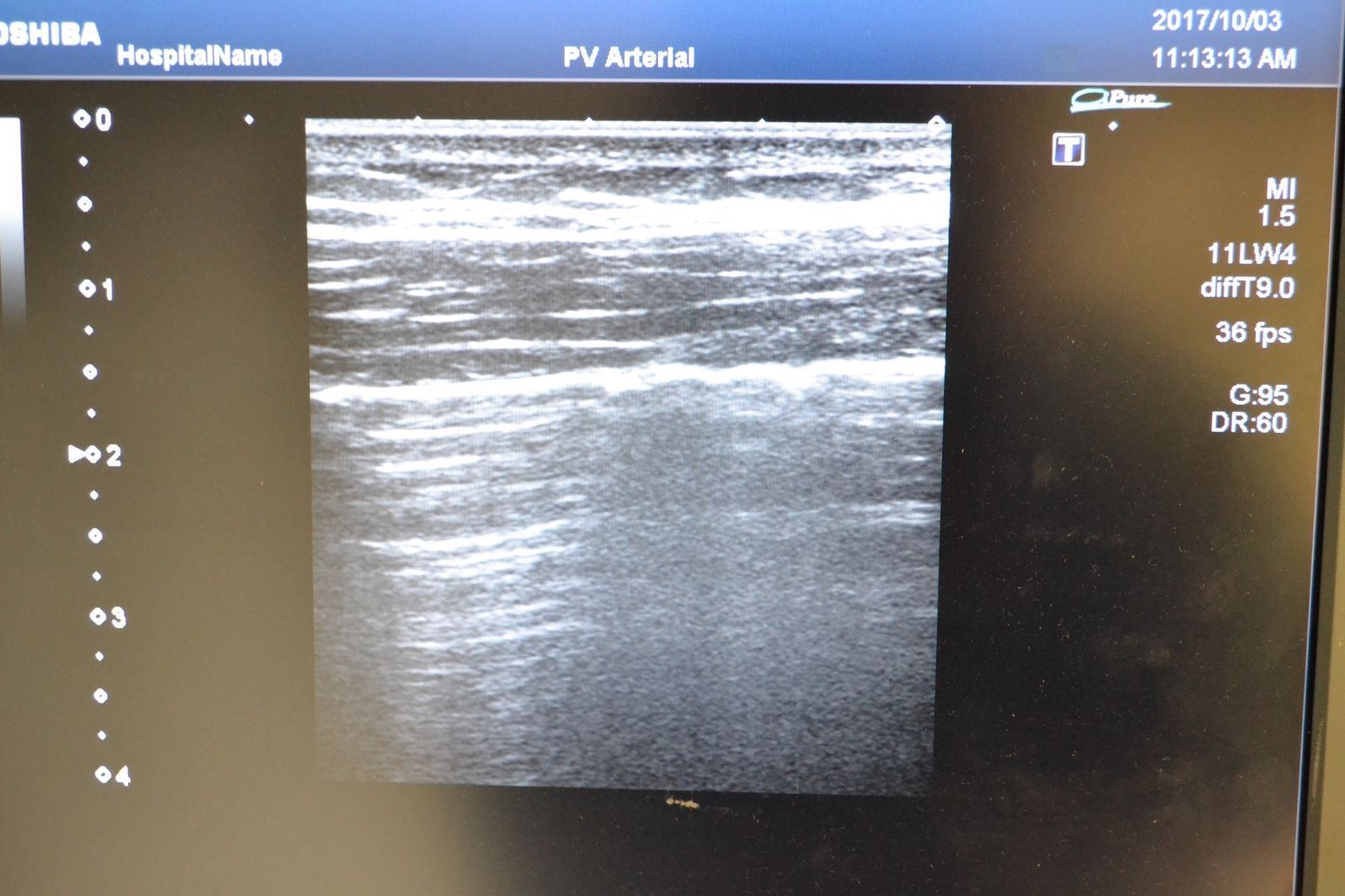 Toshiba Artida PLT-704SBT 11-4.8MHz Linear Ultrasound Transducer Probe J1626 DIAGNOSTIC ULTRASOUND MACHINES FOR SALE