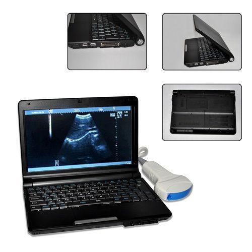 FULL Digital Laptop Ultrasound Scanner+Linear & Transvaginal 2 probe 3D Sale CE DIAGNOSTIC ULTRASOUND MACHINES FOR SALE