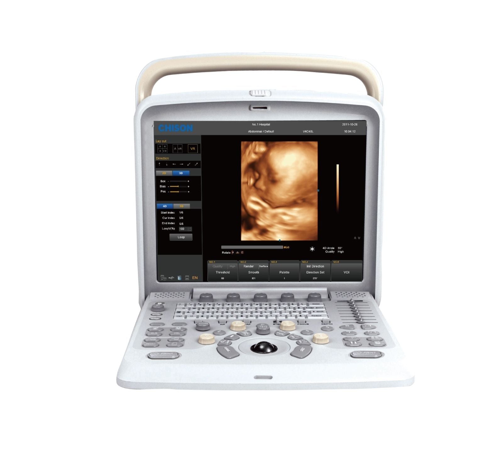 Color Doppler Ultrasound Chison Q5, 4D Probe-Obstetrics Gynecology New Warranty DIAGNOSTIC ULTRASOUND MACHINES FOR SALE
