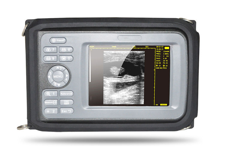 Sale Human Laptop Digital Ultrasound machine Scanner system 7.5Mhz Linear Probe 190891758767 DIAGNOSTIC ULTRASOUND MACHINES FOR SALE