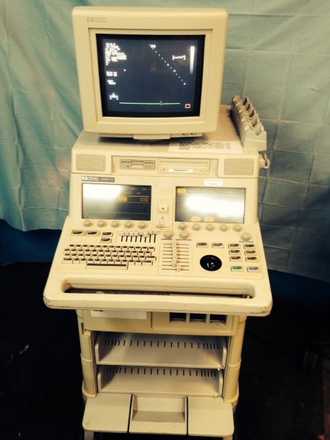 vertical shot of ultrasound