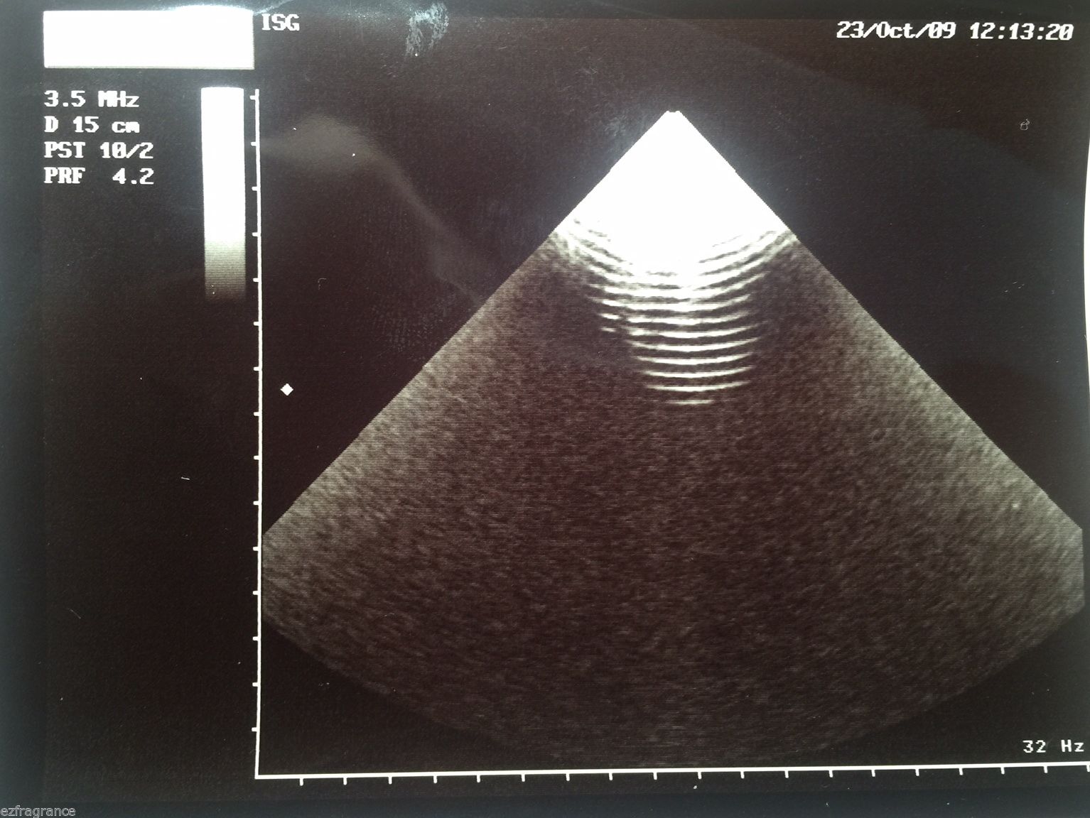 Esaote PA220E Phased Array Ultrasound Probe for Megas Caris Plus Technos USED DIAGNOSTIC ULTRASOUND MACHINES FOR SALE