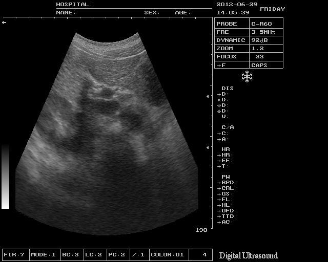 Medical Ultrasound Scanner Machine +7.5Mhz Linear Probe +3D Software 3 Years w 190891866943 DIAGNOSTIC ULTRASOUND MACHINES FOR SALE