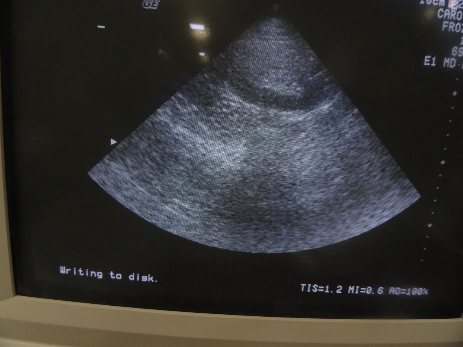 GE 227s P/N 2118743 Phased Array 2-4 MHz Probe W/ Hook for GE Logiq 700 (5979 DIAGNOSTIC ULTRASOUND MACHINES FOR SALE