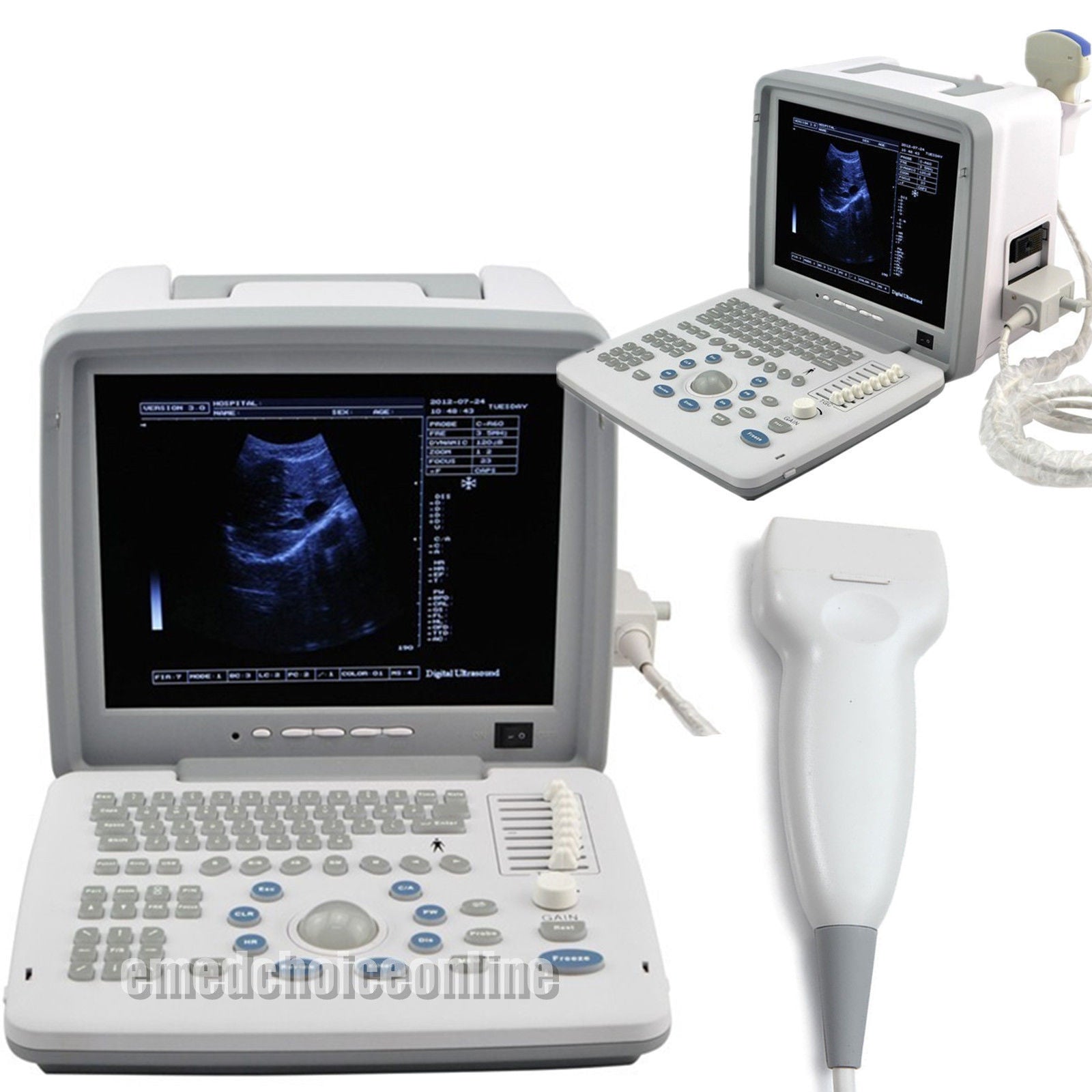 Portable Ultrasound Scanner/Machine +7.5MHz Linear Probe/Transducer Free 3D 190891434975 DIAGNOSTIC ULTRASOUND MACHINES FOR SALE