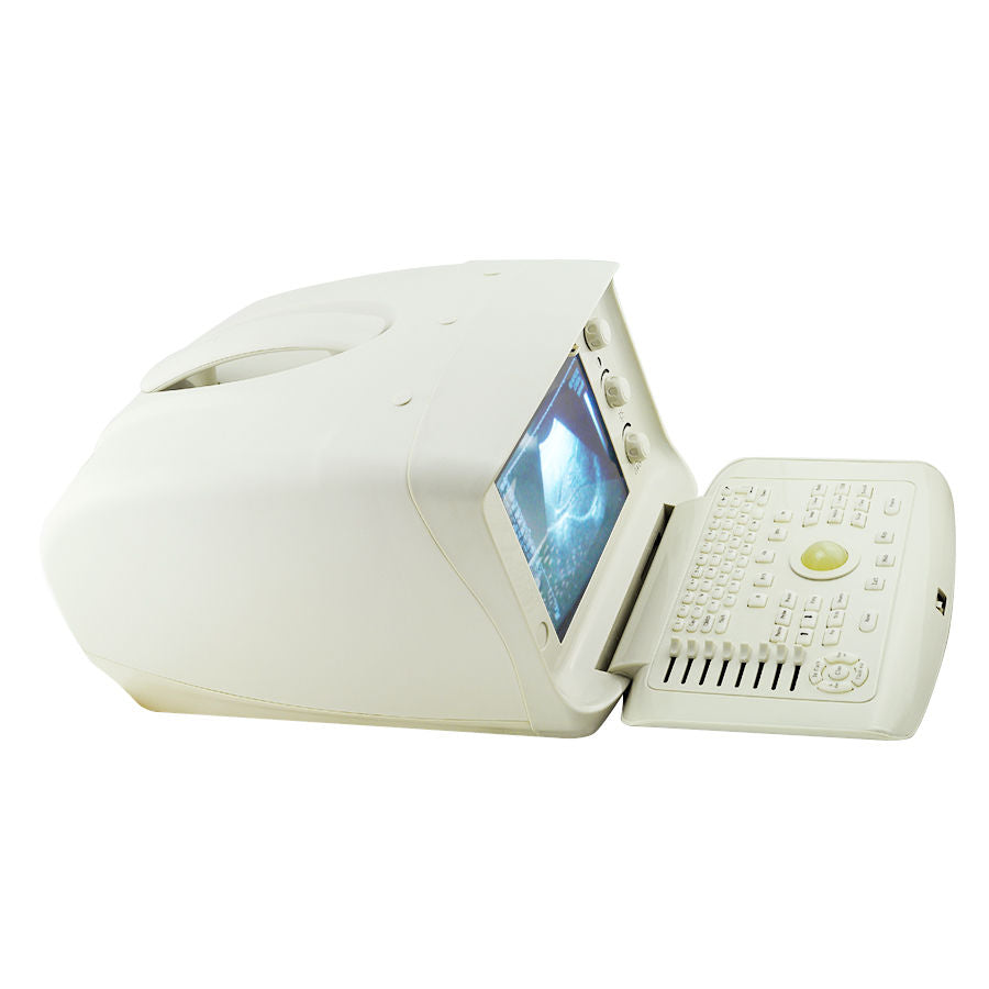 New Digital Ultrasound Scanner Machine System CE, Convex + Transvaginal Probe 3D 190891052773 DIAGNOSTIC ULTRASOUND MACHINES FOR SALE
