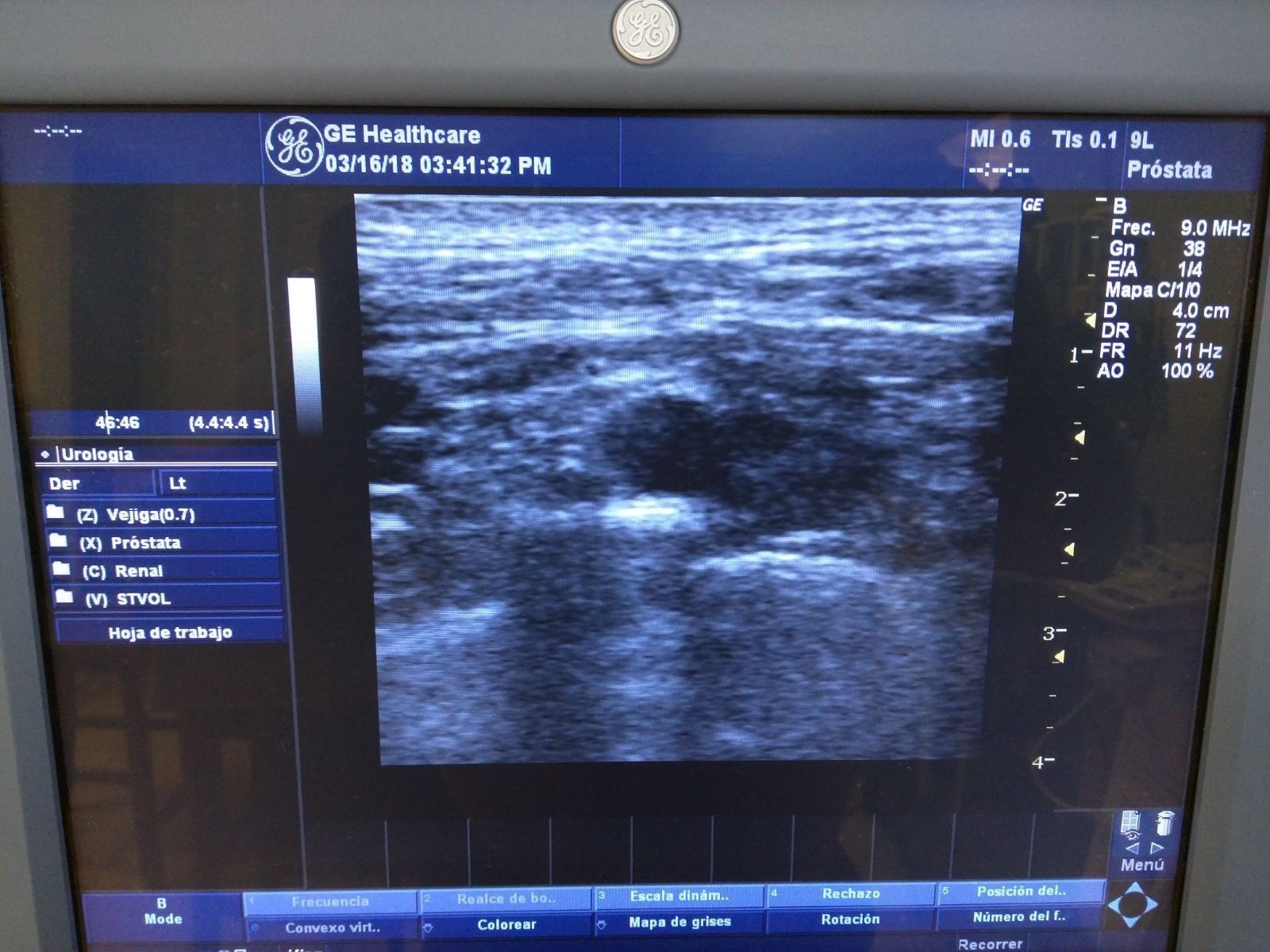 GE LOGIQ P5 2007 ULTRASOUND SYSTEM W/3 PROBES 4C CONVEX & 9L LINEAR & E8C TRANSV DIAGNOSTIC ULTRASOUND MACHINES FOR SALE