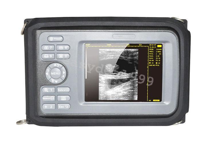 H8 Portable Handheld Full Digital Ultrasound Scanner Machine Micro-Convex Probe DIAGNOSTIC ULTRASOUND MACHINES FOR SALE