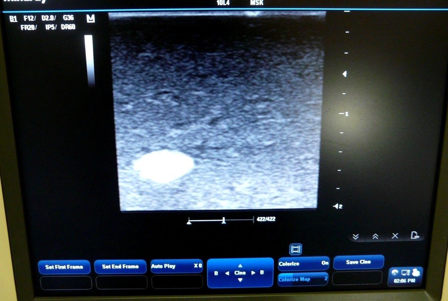 Mindray DC-3 Ultrasound Machine w/ 10L4 Transducer & Sony UP897MD Printer DIAGNOSTIC ULTRASOUND MACHINES FOR SALE