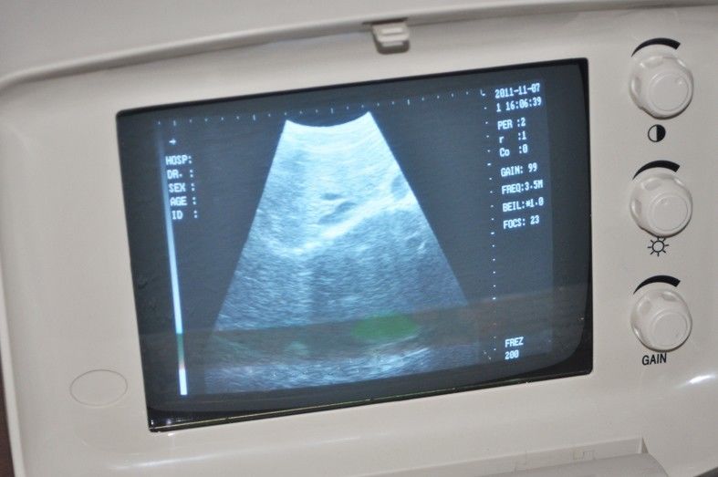 Digital Diagnose System Ultrasound Scanner Monitor Convex+Linear Probe 3D Image DIAGNOSTIC ULTRASOUND MACHINES FOR SALE