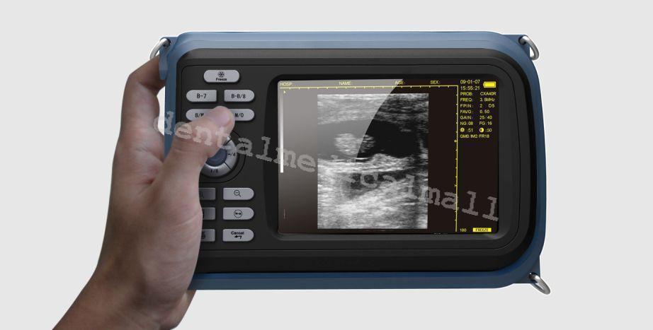 Portable Handheld full Digital Ultrasound Scanner Machine linear Probe HUMAN bid DIAGNOSTIC ULTRASOUND MACHINES FOR SALE