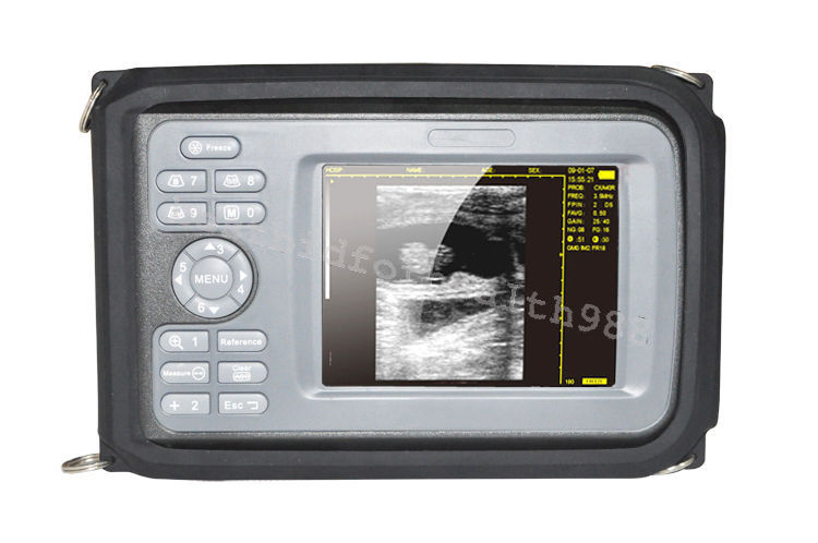 Mom Elder Check Kit Digital Handheld LCD Ultrasound Scanner + Transvaginal Probe 190891829276 DIAGNOSTIC ULTRASOUND MACHINES FOR SALE