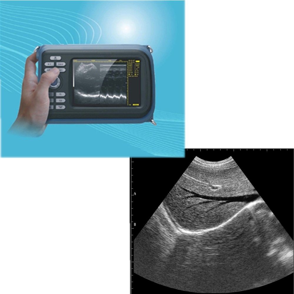 Sale Human Laptop Digital Ultrasound machine Scanner system 7.5Mhz Linear Probe 190891758767 DIAGNOSTIC ULTRASOUND MACHINES FOR SALE