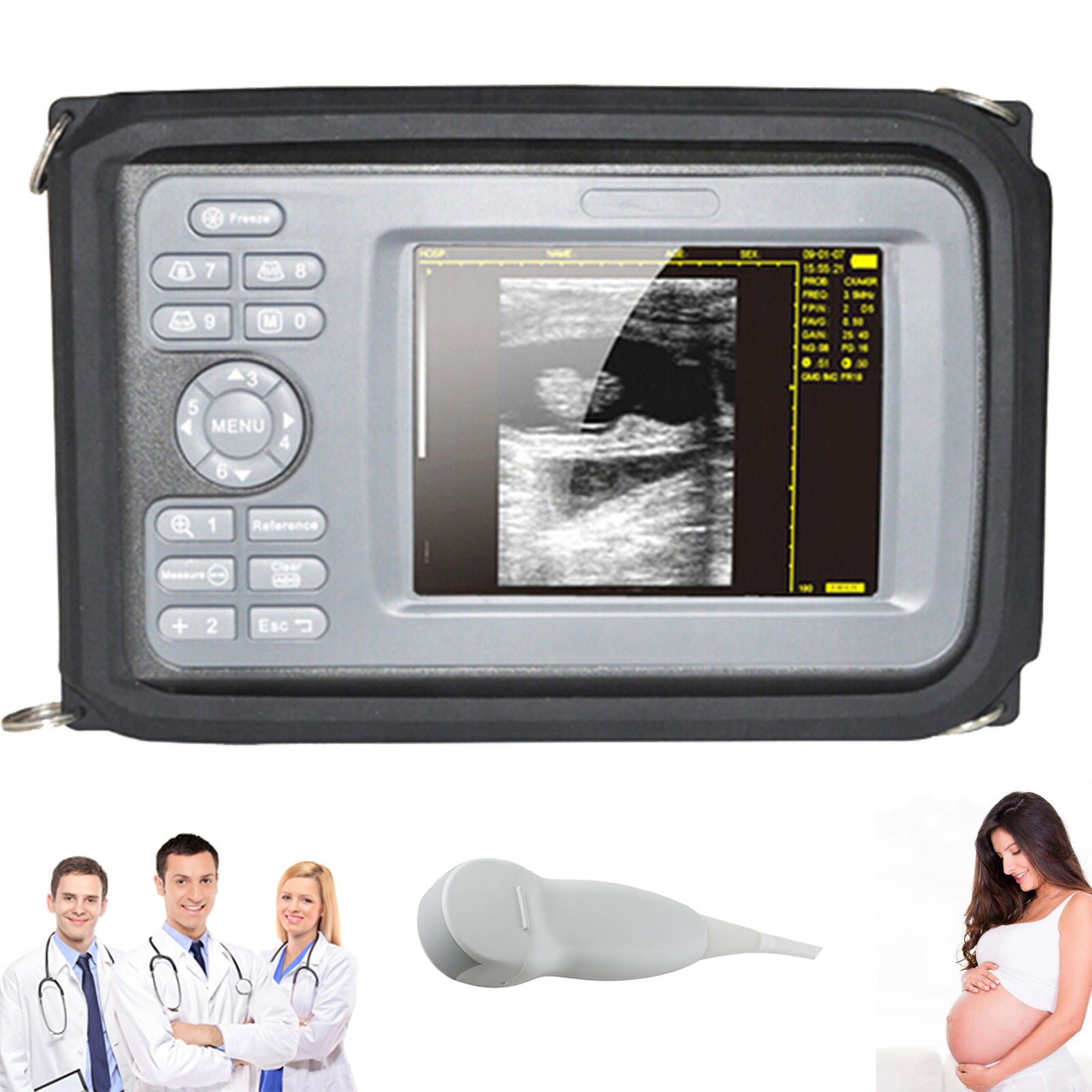 Digital Palm Smart Ultrasound Scanner +5Mhz Micro-convex Probe Human Cardiology 190891769312 DIAGNOSTIC ULTRASOUND MACHINES FOR SALE