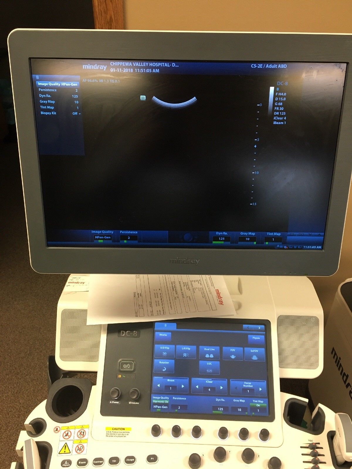 Mindray ultrasound dc-8 DIAGNOSTIC ULTRASOUND MACHINES FOR SALE