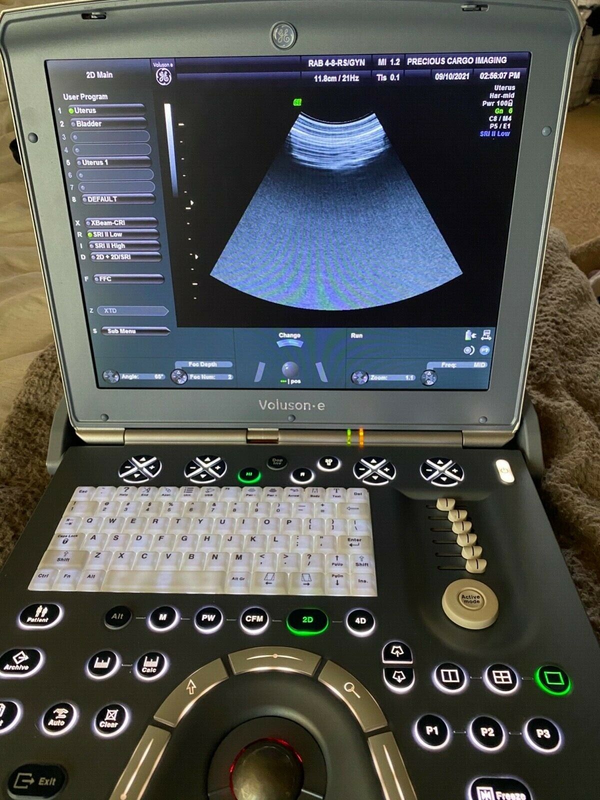 GE Voluson E Portable Ultrasound Machine with 3D4D Probe DIAGNOSTIC ULTRASOUND MACHINES FOR SALE
