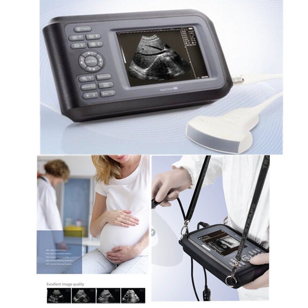 Portable laptop Machine Ultrasound Scanner Convex +Linear +Transvaginal 3 Probe DIAGNOSTIC ULTRASOUND MACHINES FOR SALE