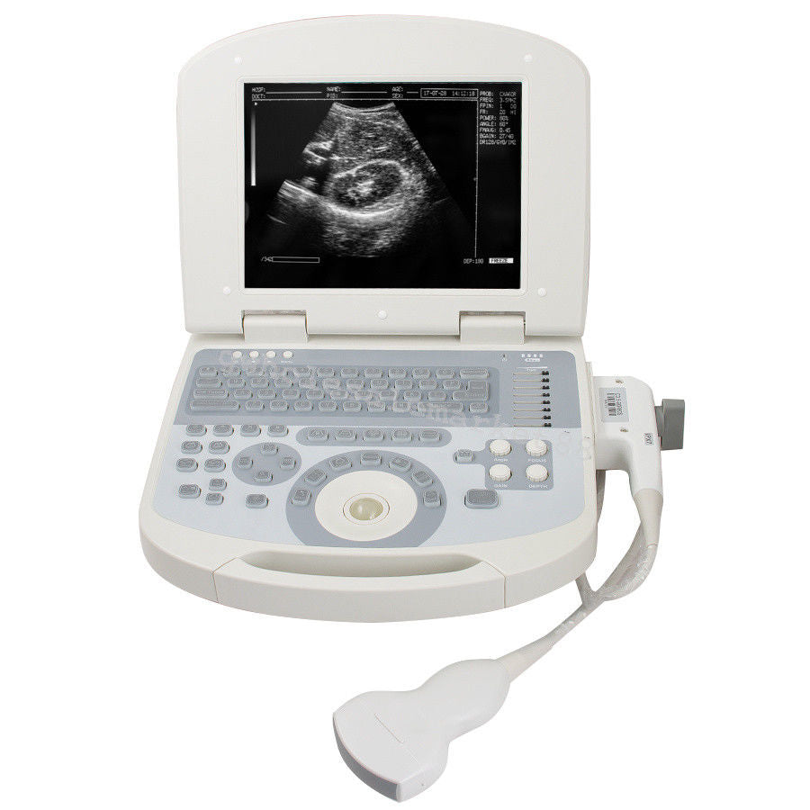 Portable Ultrasound Machine Scanner System Convex probe 3D Software Best Image 190891045898 DIAGNOSTIC ULTRASOUND MACHINES FOR SALE