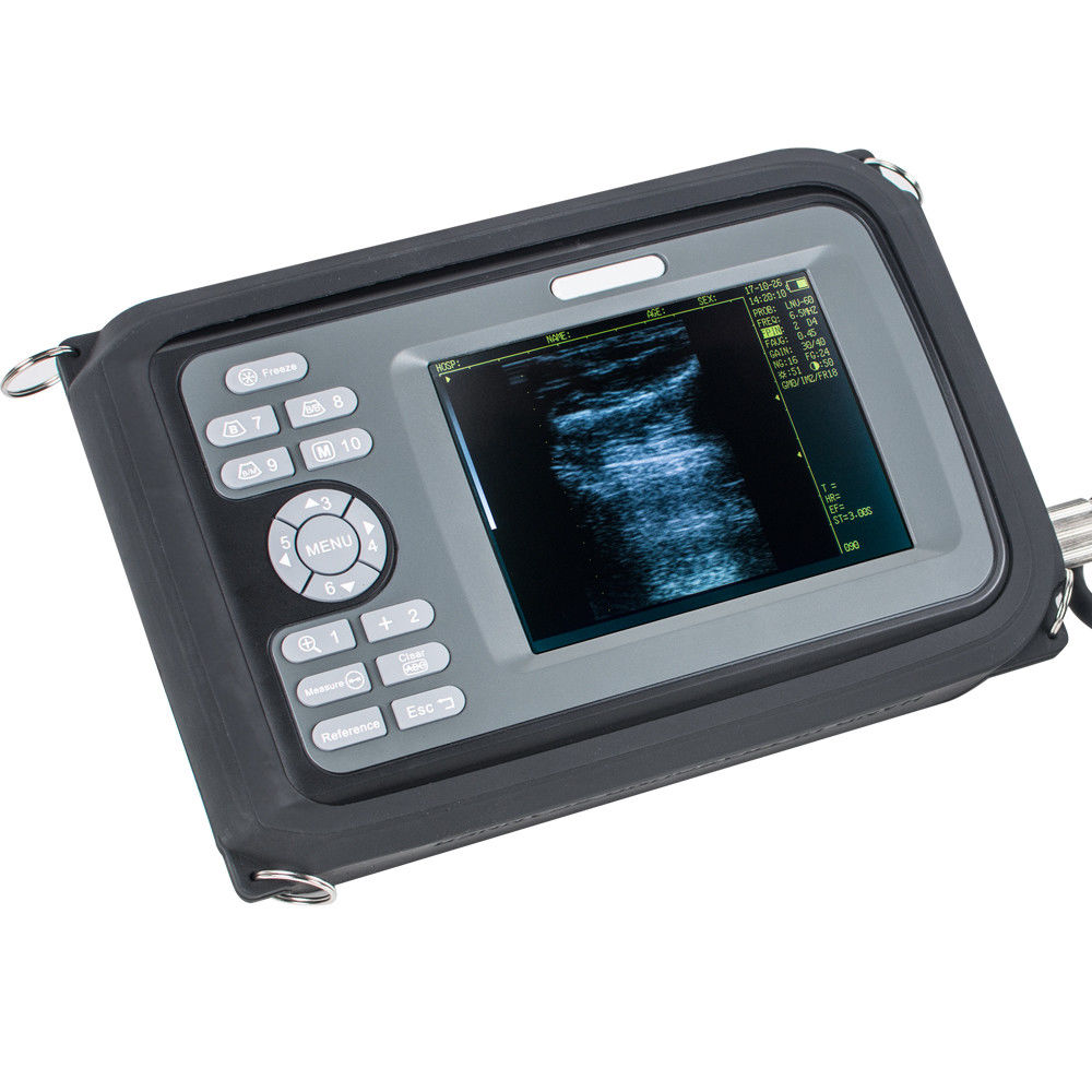 Factory Handheld PalmSmart Ultrasound Scanner/Machine Cardiac Micro-Convex Probe DIAGNOSTIC ULTRASOUND MACHINES FOR SALE