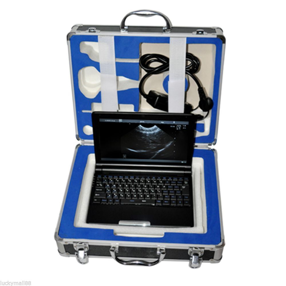 Hospital Laptop Machine Ultrasound Scanner Convex/Linear/Endovaginal Probe +Case 190891044686 DIAGNOSTIC ULTRASOUND MACHINES FOR SALE