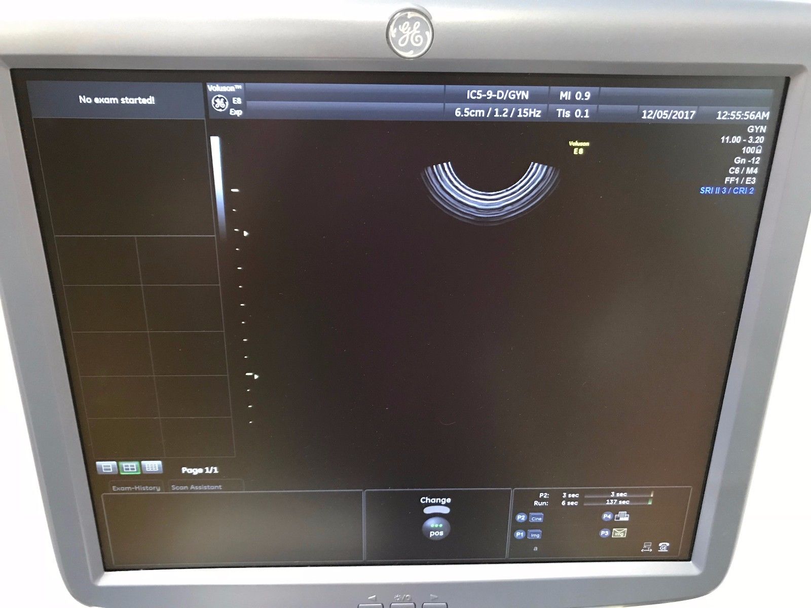 GE VOLUSON E8 BT13 HD LIVE ULTRASOUND WITH RM6C, C1-5D, IC5-9D PROBES DIAGNOSTIC ULTRASOUND MACHINES FOR SALE