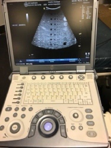 GE Vivid E Cardiac/Vascular/General Portable Ultrasound with 4 probes DIAGNOSTIC ULTRASOUND MACHINES FOR SALE
