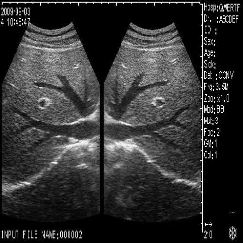 Portable Diagnostic Ultrasound Scanner Convex +Transvaginal 2 Probe 3D Pregnancy 190891054135 DIAGNOSTIC ULTRASOUND MACHINES FOR SALE