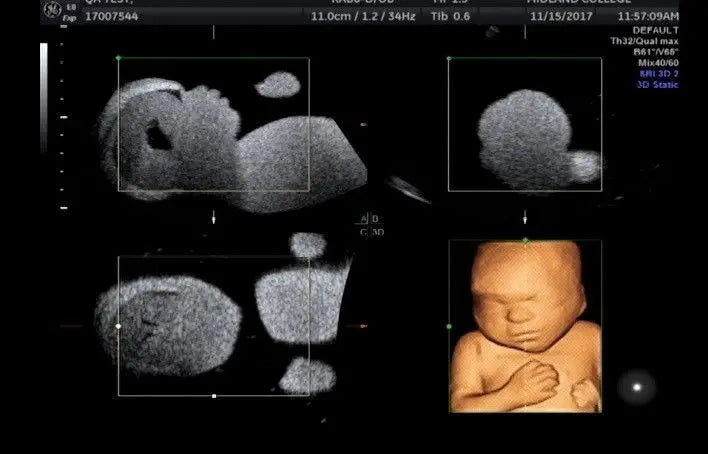 GE Voluson E8 BT13 with HDLive Ultrasound System DIAGNOSTIC ULTRASOUND MACHINES FOR SALE