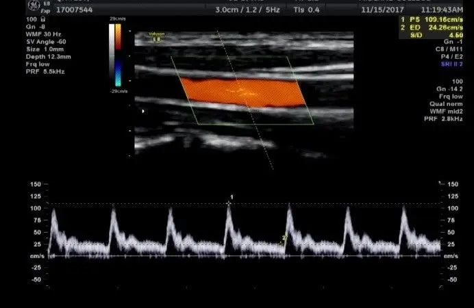 GE Voluson E8 BT13 with HDLive Ultrasound System DIAGNOSTIC ULTRASOUND MACHINES FOR SALE